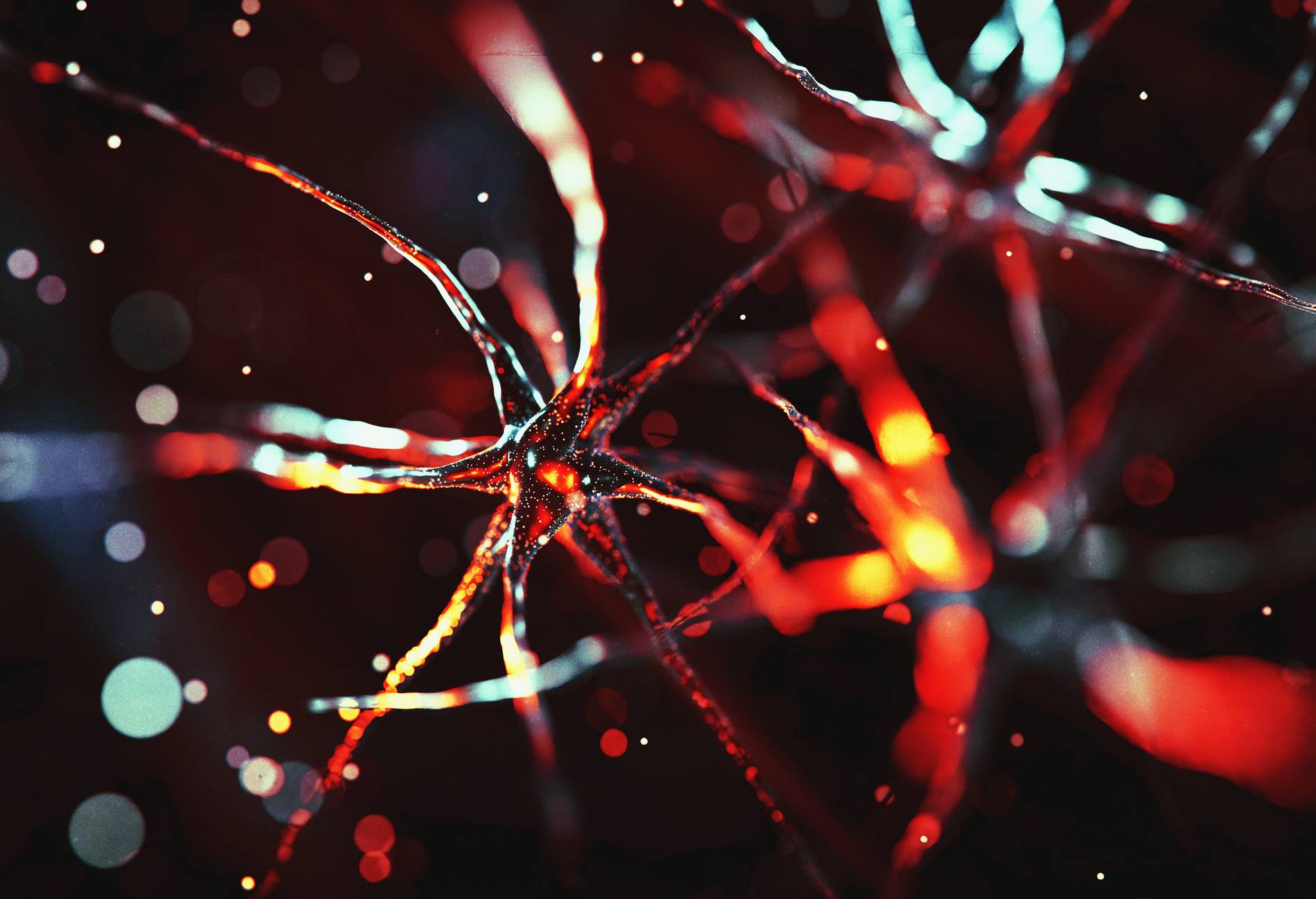 Neuron cells system disease - 3d rendered image of Neuron cell network on black background. Interconnected neurons cells with electrical pulses. Conceptual medical image.  Glowing synapse.  Healthcare, disease concept.